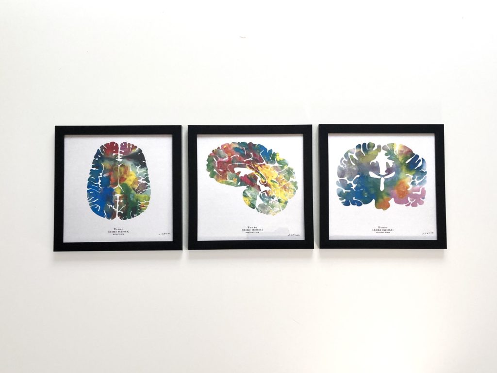 neuroscience art prints set of three black frames sagittal axial coronal views human brain art psychology art