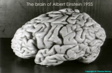 Brain of Albert Einstein - Wikipedia