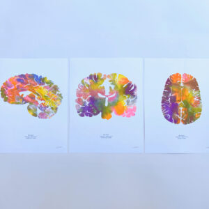 Human brain art risograph print set of 3 by J. Sayuri: axial, coronal and sagittal views side by side